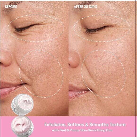 ALPYN Peel & Plump Moisturizer Duo - Picture 8 of 15